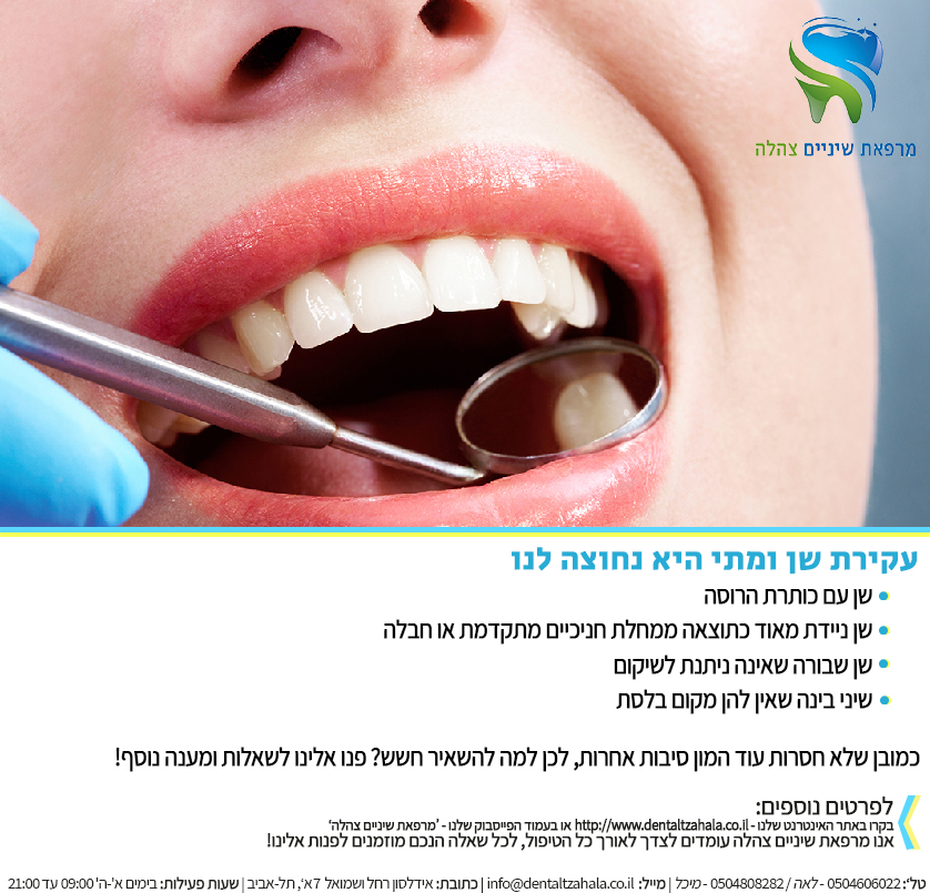 Entry 124596 in Portfolio by Eldar Nissim