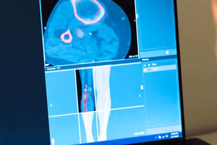 Open Zoomed Related Entry 3d-systems-healthcare-development-img-3.jpg
