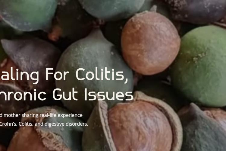 XPlace | Hire Freelancers, Find Freelance Jobs