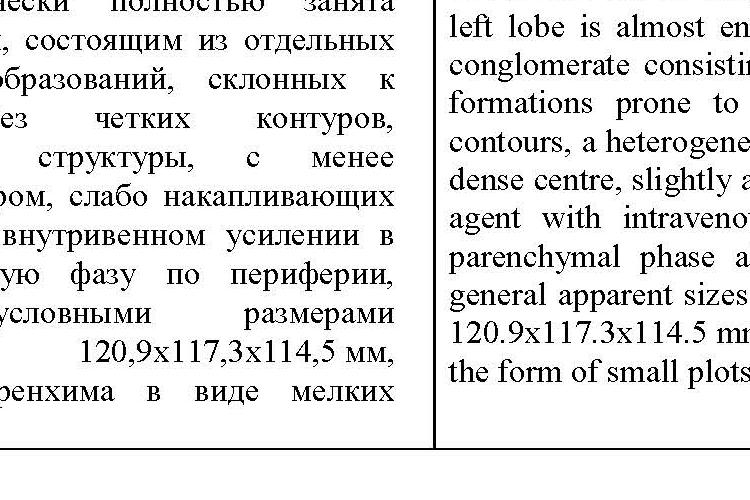 Open Zoomed Related Entry Мультисрезовая компьютерная томография_RU_EN.jpg