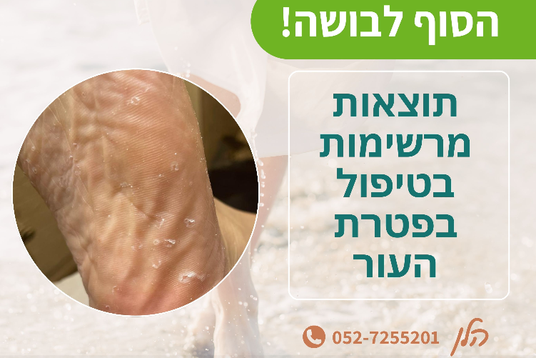 הלן בר און thumbnail